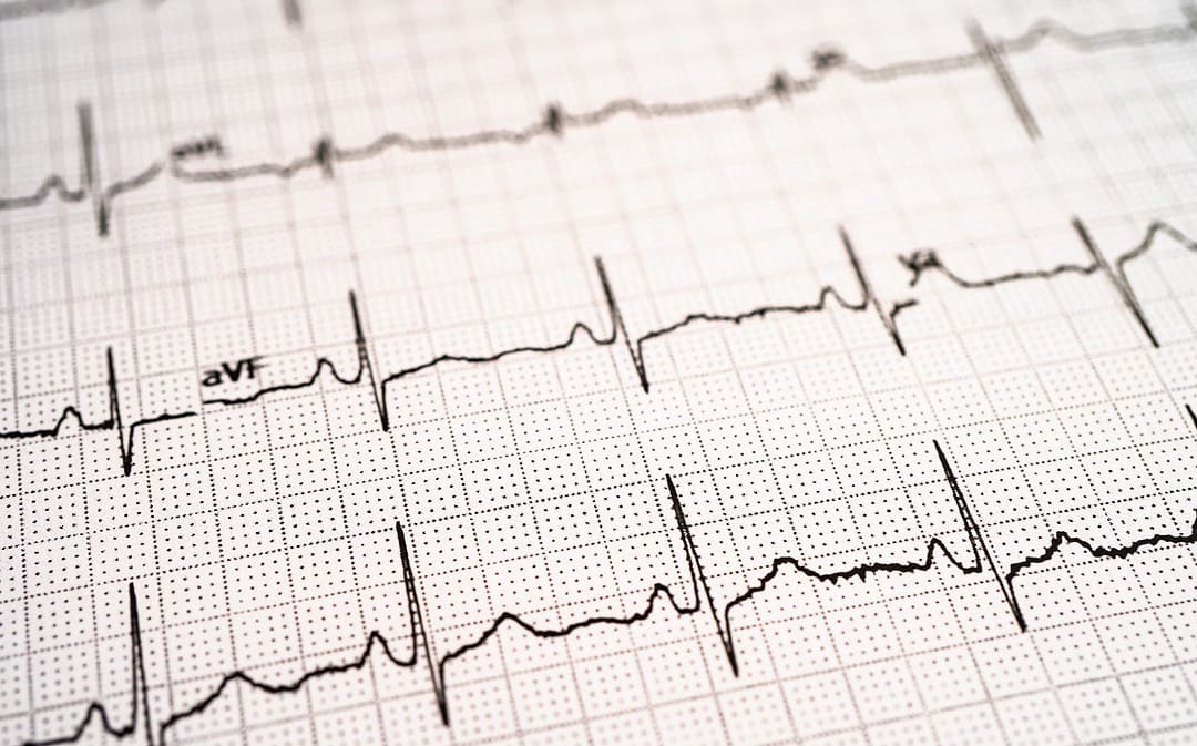 Potential of Hexarelin Peptide in Cardiovascular Health