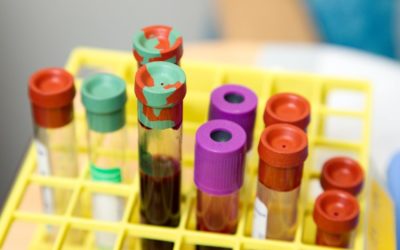 MGF Peptide Splicing May Help Maximize Gains