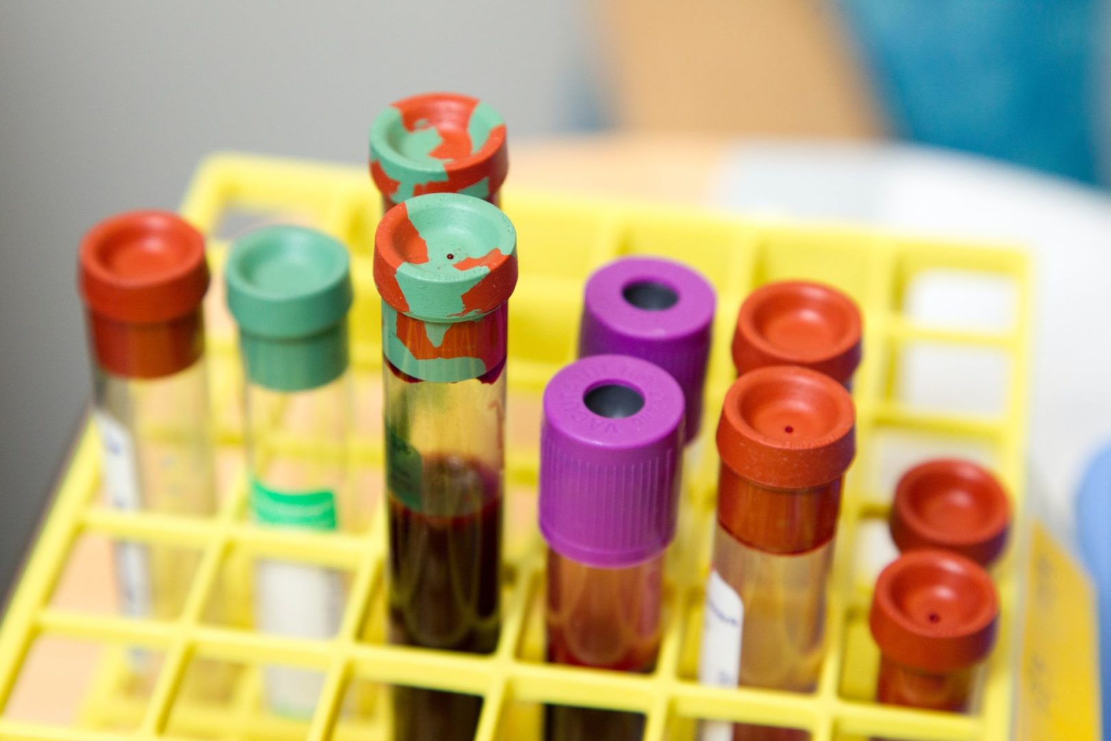 MGF Peptide Splicing May Help Maximize Gains - Core Peptides
