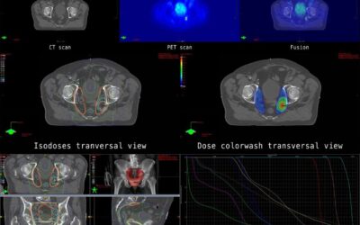 Prostamax Peptide and Cell Aging, Prostate, and Immunology Studies