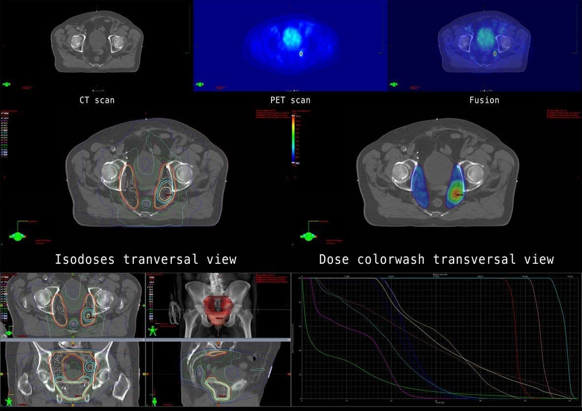 Prostamax Peptide and Cell Aging, Prostate, and Immunology Studies