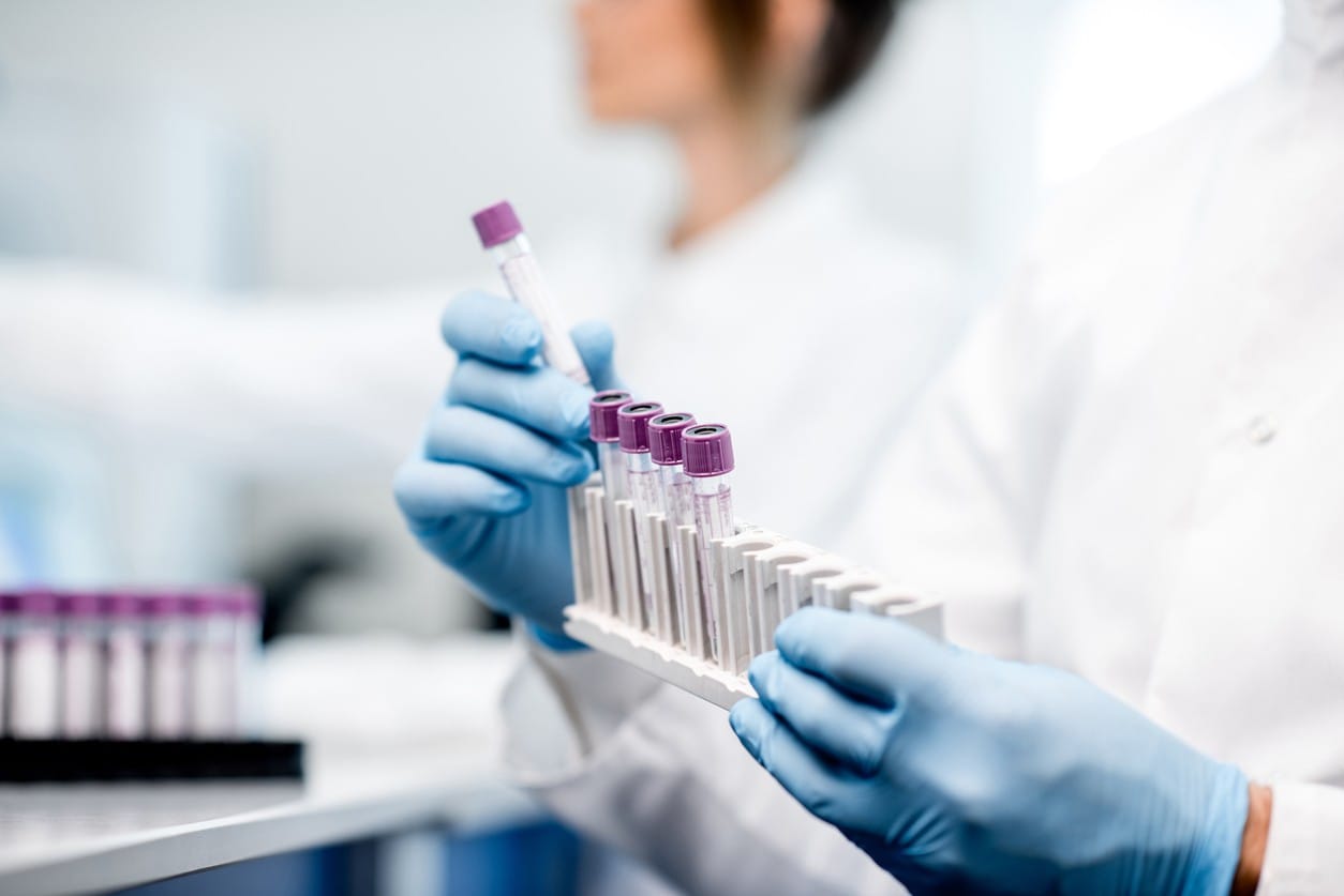 PEGylated MGF Skeletal Muscle Cell Regeneration and Cardiac Protection